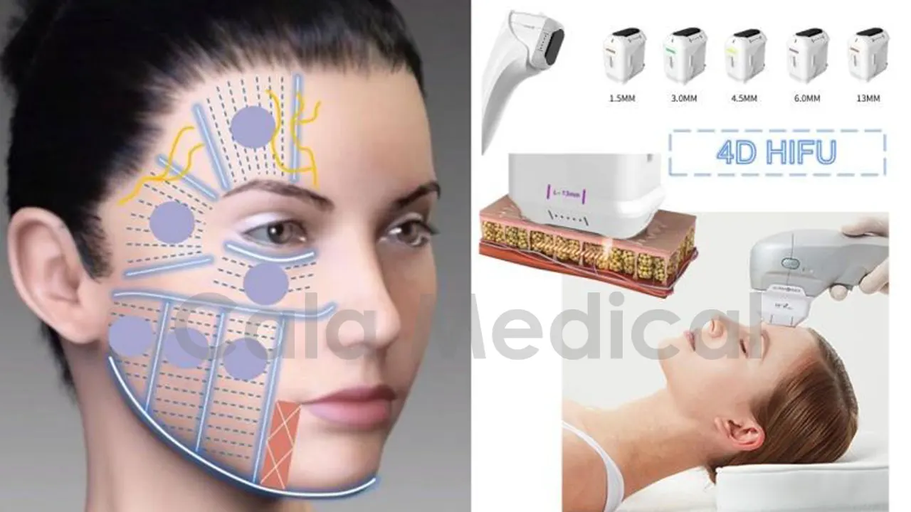 دستگاه هایفو چهار بعدی اولترا 4D